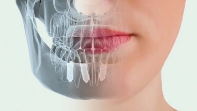 Cirugía Bucal y Máxilofacial