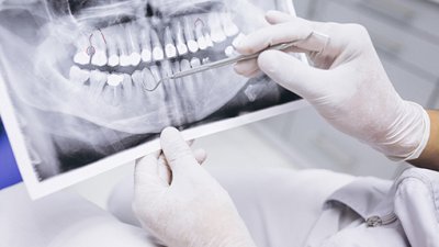 Maestría en Radiología Bucal y Máxilofacial
