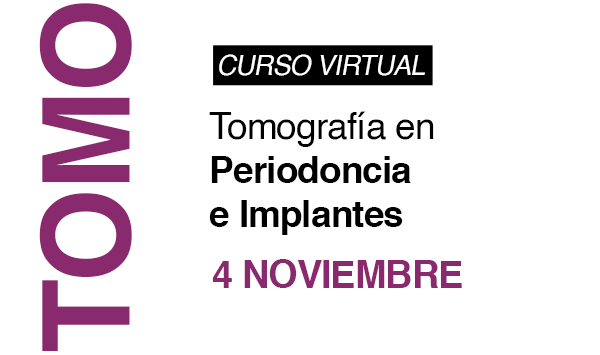 TOMOGRAFÍA EN PERIODONCIA E IMPLANTES