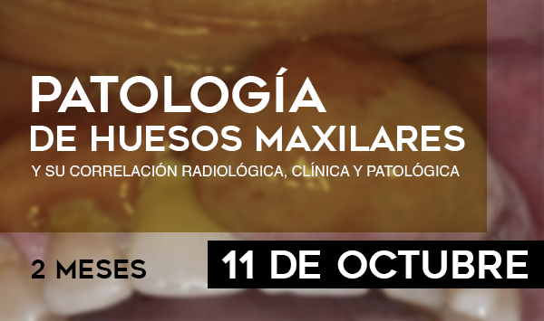 Patología de Los Huesos Maxilares y su Correlación Clínica Radiológica