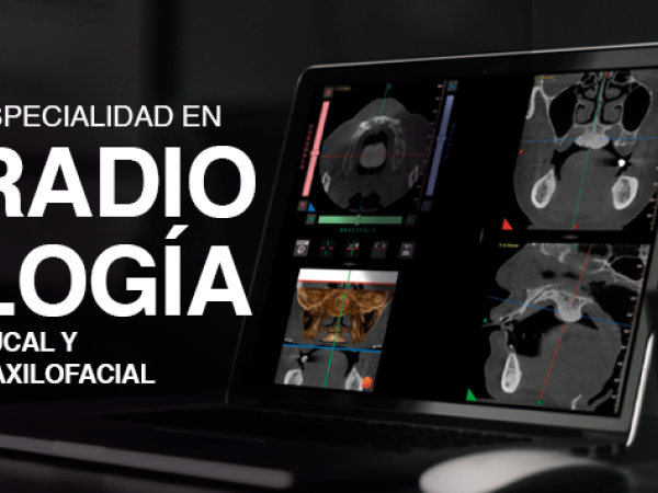 Especialidad en Radiología Bucal y Maxilofacial
